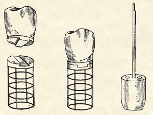 dental implant illustration