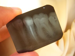 dental x-ray 